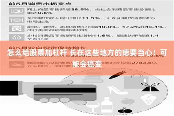 怎么给股票加杠杆 长在这些地方的痣要当心！可能会癌变